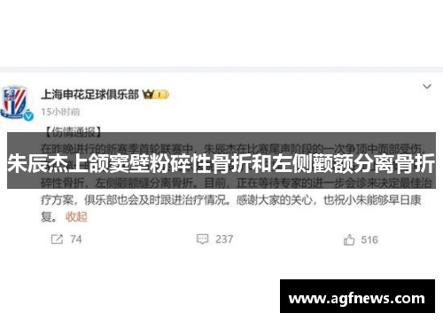 朱辰杰上颌窦壁粉碎性骨折和左侧颧额分离骨折